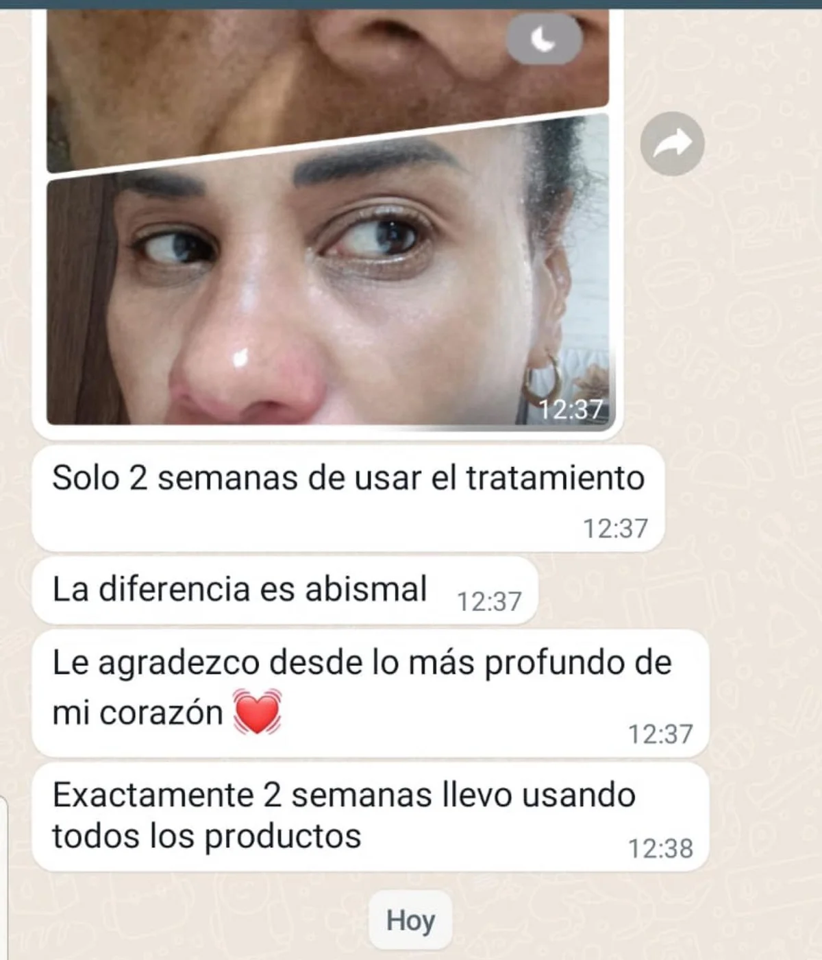 Anúncio da Botica Alemana no formato Comparativo e Print de Conversa