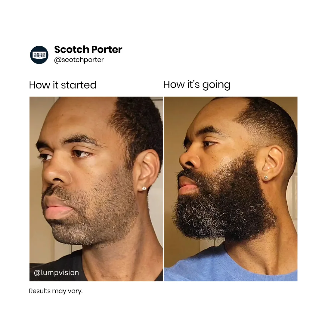 Anúncio da Scotch Porter no formato Antes e Depois e UGC