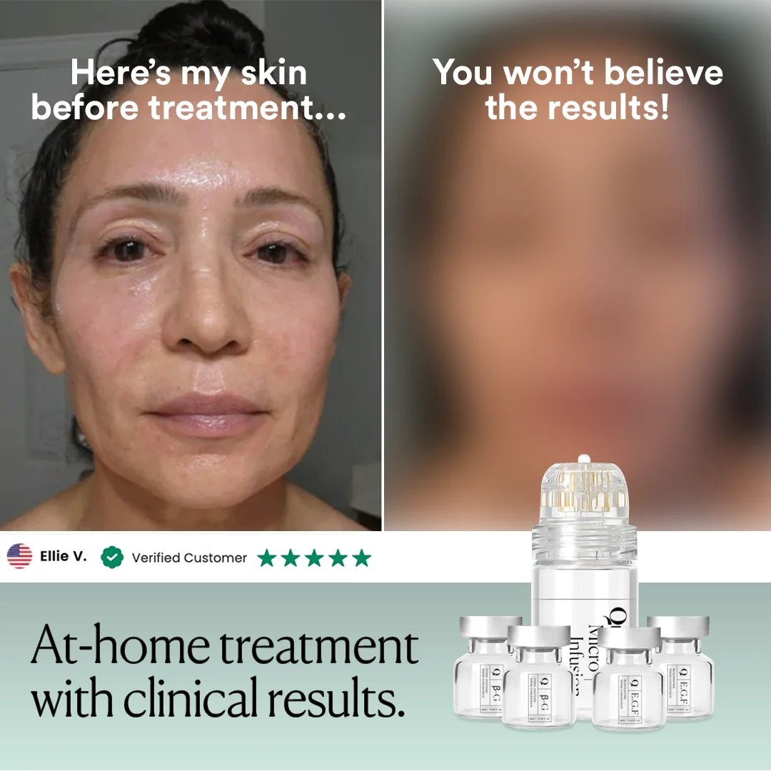 Anúncio da Qure Skincare no formato Antes e Depois e UGC